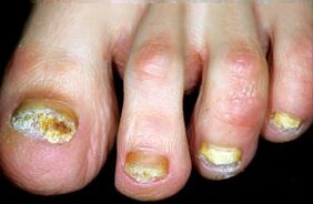 Haiguse iseloomustamine