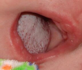 Haiguse lokaliseerimine seenega