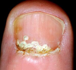 Haiguse sümptomid ja tunnused